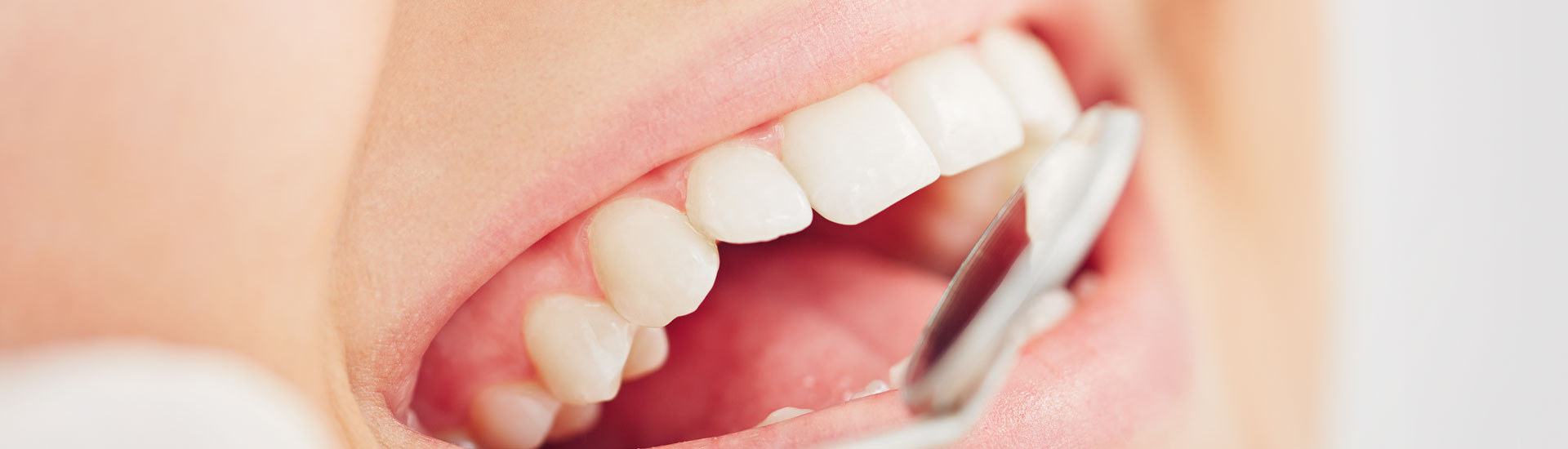 Healthy teeth with biomimetic dentistry